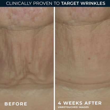 Retinol Firming Serum Bars – Anti Aging Face & Neck Care Treatment