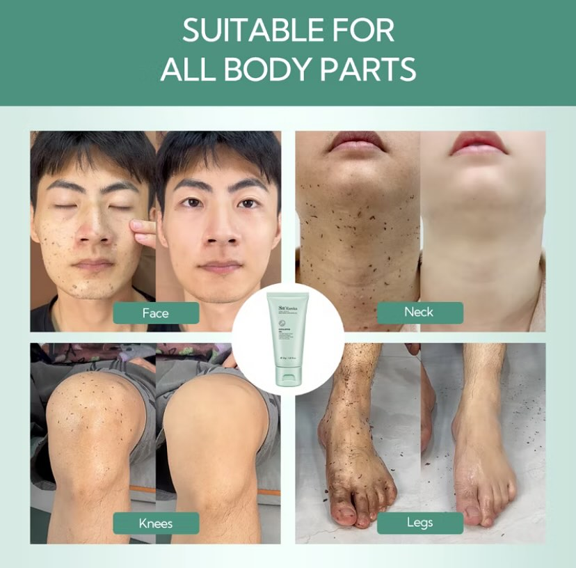 Exfoliating Gel for Face & Body – Deep Clean Scrub