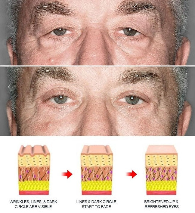 Lifting Eye Gel – Rejuvenating Eye Care Solution