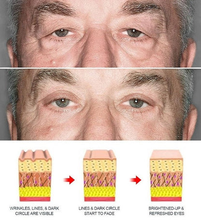 Lifting Eye Gel – Rejuvenating Eye Care Solution