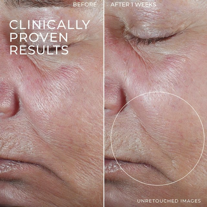 Retinol Firming Serum Bars – Anti Aging Face & Neck Care Treatment