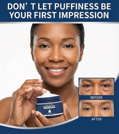 Lifting Eye Gel – Rejuvenating Eye Care Solution