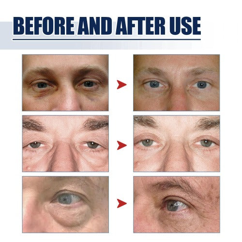 Lifting Eye Gel – Rejuvenating Eye Care Solution