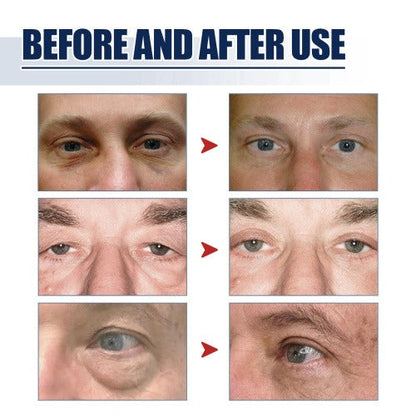 Lifting Eye Gel – Rejuvenating Eye Care Solution