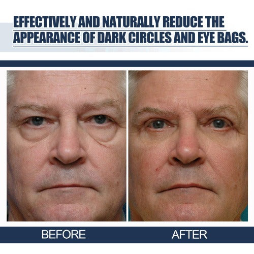 Lifting Eye Gel – Rejuvenating Eye Care Solution