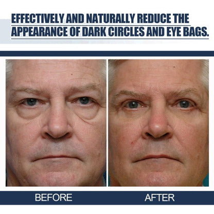 Lifting Eye Gel – Rejuvenating Eye Care Solution