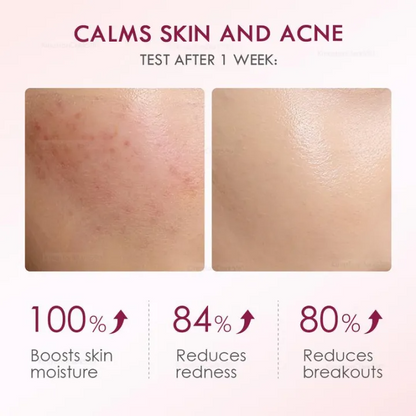 Krimu ya Jeli ya Unyevu – Hyaluronic Acid na Ceramide kwa Ulainishaji wa Uso